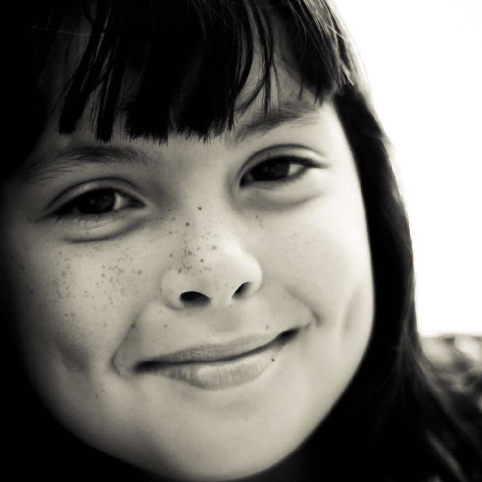 Freckles